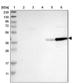 Lane 1: Marker [kDa] 230, 130, 95, 72, 56, 36, 28, 17, 11_br/_Lane 2: Human cell line RT-4_br/_Lane 3: Human cell line U-251MG sp_br/_Lane 4: Human plasma (IgG/HSA depleted)_br/_Lane 5: Human liver tissue_br/_Lane 6: Human tonsil tissue