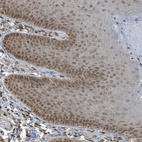 Immunohistochemical staining of human skin shows moderate nuclear positivity in squamous epithelial cells.