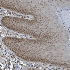 Immunohistochemical staining of human skin shows moderate nuclear positivity in squamous epithelial cells.