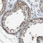 Immunohistochemical staining of human testis shows strong nuclear positivity in subset of cells in seminiferous ducts.