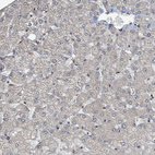 Immunohistochemical staining of human liver shows no positivity in hepatocytes as expected.