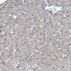 Immunohistochemical staining of human liver shows no positivity in hepatocytes as expected.