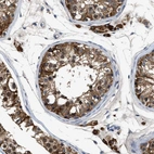 Immunohistochemical staining of human testis shows high expression.