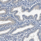 Immunohistochemical staining of human endometrium shows low expression as expected.