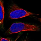 Immunofluorescent staining of human cell line U-2 OS shows localization to vesicles.