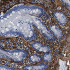 Immunohistochemical staining of human duodenum shows strong membranous positivity in smooth muscle cells.