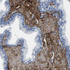 Immunohistochemical staining of human prostate shows strong membranous positivity in smooth muscle cells.