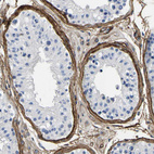 Immunohistochemical staining of human testis shows strong membranous positivity in collagen fibers.