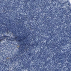 Immunohistochemical staining of human tonsil shows no positivity in non-germinal center cells as expected.