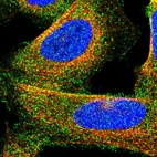 Immunofluorescent staining of human cell line U-2 OS shows localization to cytosol.