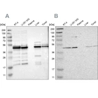 Western blot analysis using Anti-UQCRC2 antibody HPA019146 (A) shows similar pattern to independent antibody HPA007998 (B).