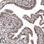 Immunohistochemical staining of human fallopian tube shows moderate to strong nuclear positivity in glandular cells.