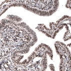 Immunohistochemical staining of human fallopian tube shows moderate to strong nuclear positivity in glandular cells.