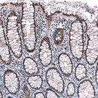 Immunohistochemical staining of human colon shows moderate to strong nuclear positivity in glandular cells.