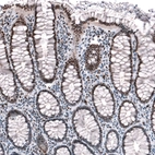 Immunohistochemical staining of human colon shows moderate to strong nuclear positivity in glandular cells.