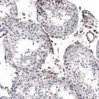 Immunohistochemical staining of human testis shows moderate nuclear positivity in a subset of cells in seminiferous ducts.