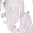 Immunohistochemical staining of human skeletal muscle shows no positivity in striated muscle fibers as expected.