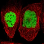 Immunofluorescent staining of human cell line A-431 shows localization to nucleoplasm.