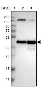 Lane 1: Marker [kDa] 230, 130, 95, 72, 56, 36, 28, 17, 11_br/_Lane 2: Human cell line RT-4_br/_Lane 3: Human cell line U-251MG sp