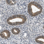 Immunohistochemical staining of human endometrium shows strong cytoplasmic positivity in glandular cells.