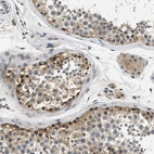 Immunohistochemical staining of human testis shows moderate cytoplasmic positivity in cells in seminiferous ducts.