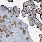 Immunohistochemical staining of human placenta shows moderate to strong cytoplasmic and nuclear positivity in trophoblastic and decidual cells.