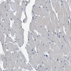 Immunohistochemical staining of human skeletal muscle shows no positivity in myocytes as expected.