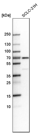 Western blot analysis in human cell line SCLC-21H.