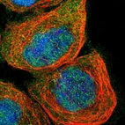 Immunofluorescent staining of human cell line A-431 shows localization to nucleoplasm, cytosol & centrosome.