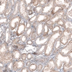 Immunohistochemical staining of human kidney shows weak to moderate cytoplasmic positivity in cells in tubules.