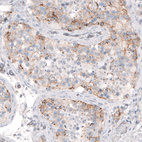 Immunohistochemical staining of human testis shows weak to moderate cytoplasmic positivity in cells in seminiferous ducts.