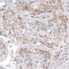 Immunohistochemical staining of human testis shows weak to moderate cytoplasmic positivity in cells in seminiferous ducts.