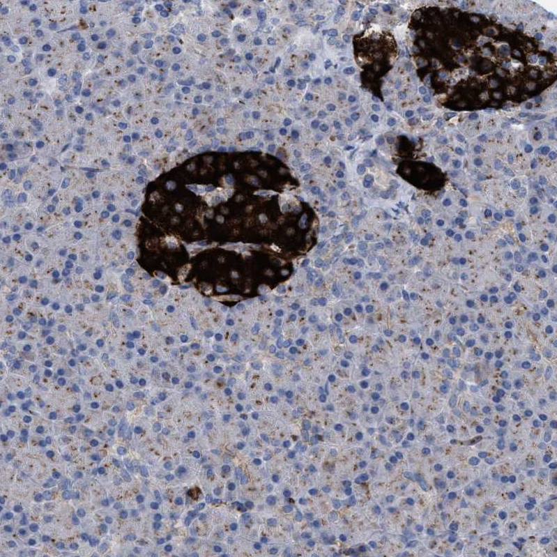 Anti-CCL2 Antibody