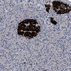 Anti-CCL2 Antibody