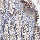 Immunohistochemical staining of human rectum shows strong cytoplasmic granular positivity in glandular cells.
