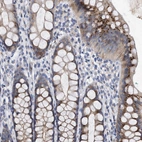 Immunohistochemical staining of human rectum shows strong cytoplasmic granular positivity in glandular cells.