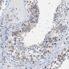 Anti-SPATC1L Antibody