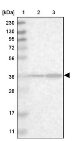 Lane 1: Marker [kDa] 230, 130, 95, 72, 56, 36, 28, 17, 11_br/_Lane 2: Human cell line RT-4_br/_Lane 3: Human cell line U-251MG sp