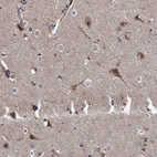 Immunohistochemical staining of human cerebral cortex, colon, heart muscle and smooth muscle using Anti-COBL antibody HPA019167 (A) shows similar protein distribution across tissues to independent antibody HPA019033 (B).