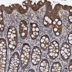 Immunohistochemical staining of human parathyroid gland shows high expression.