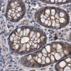 Immunohistochemical staining of human colon using Anti-COBL antibody HPA019167.