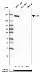 Western blot analysis in HeLa cells transfected with control siRNA, target specific siRNA probe #1 and #2, using Anti-COBL antibody. Remaining relative intensity is presented. Loading control: Anti-GAPDH.