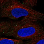 Immunofluorescent staining of human cell line U-2 OS shows localization to vesicles.