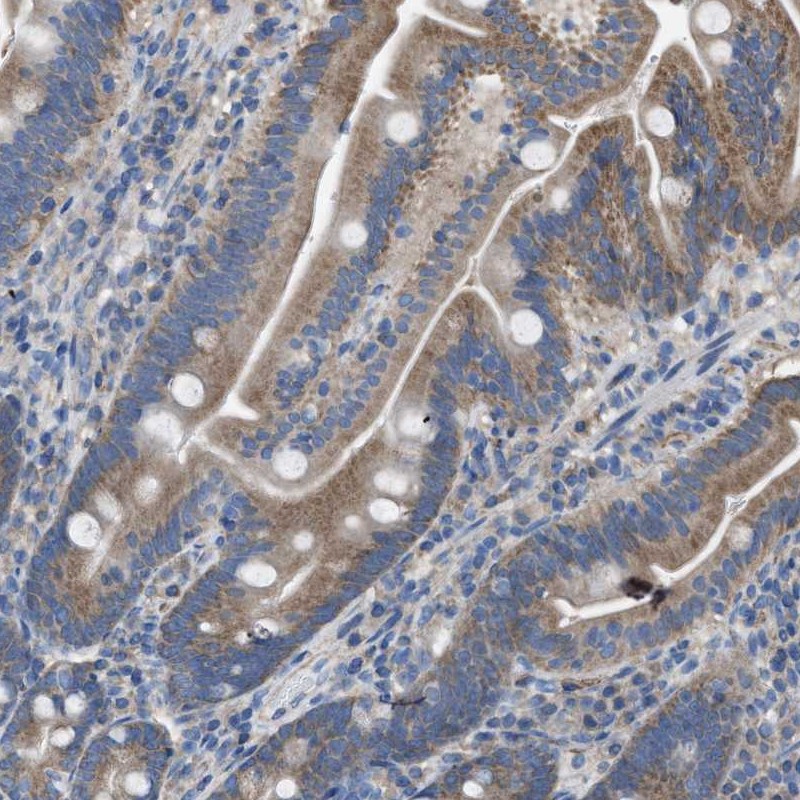 Anti-DOLPP1 Antibody