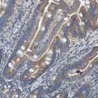 Anti-DOLPP1 Antibody