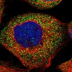 Immunofluorescent staining of human cell line A-431 shows localization to vesicles.