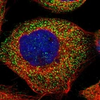 Immunofluorescent staining of human cell line A-431 shows localization to vesicles.