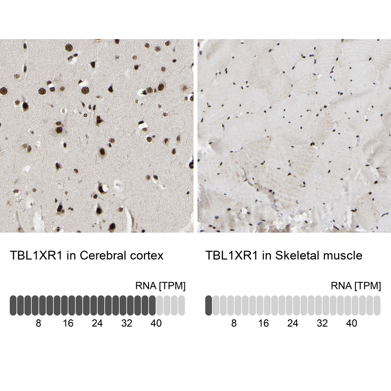 Anti-TBL1XR1 Antibody