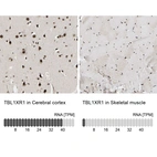 Anti-TBL1XR1 Antibody