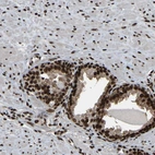 Immunohistochemical staining of human prostate shows moderate to strong nuclear positivity in glandular cells.